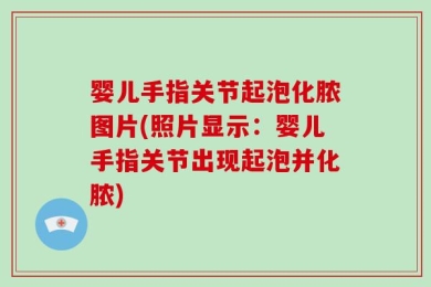 婴儿手指关节起泡化脓图片(照片显示：婴儿手指关节出现起泡并化脓)