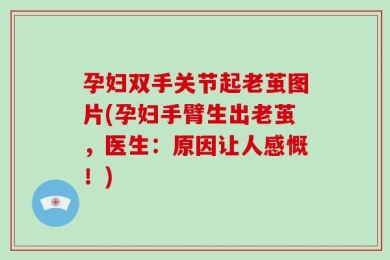 孕妇双手关节起老茧图片(孕妇手臂生出老茧，医生：原因让人感慨！)
