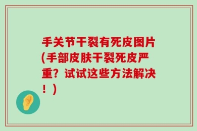 手关节干裂有死皮图片(手部皮肤干裂死皮严重？试试这些方法解决！)