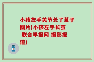 小孩左手关节长了茧子图片(小孩左手长茧  联合早报网 摄影报道)