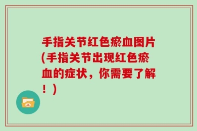 手指关节红色瘀血图片(手指关节出现红色瘀血的症状，你需要了解！)