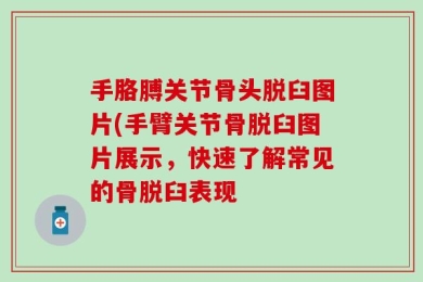 手胳膊关节骨头脱臼图片(手臂关节骨脱臼图片展示，快速了解常见的骨脱臼表现