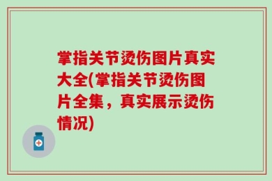 掌指关节烫伤图片真实大全(掌指关节烫伤图片全集，真实展示烫伤情况)