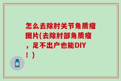 怎么去除肘关节角质瘤图片(去除肘部角质瘤，足不出户也能DIY！)