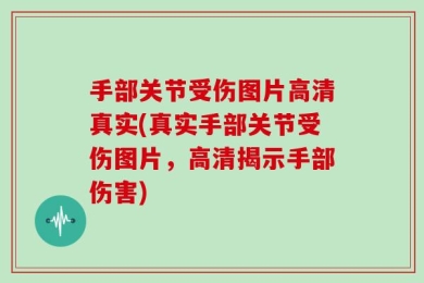 手部关节受伤图片高清真实(真实手部关节受伤图片，高清揭示手部伤害)