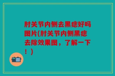 肘关节内侧去黑痣好吗图片(肘关节内侧黑痣去除效果图，了解一下！)
