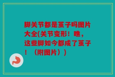 脚关节都是茧子吗图片大全(关节变形！瞧，这些脚如今都成了茧子！（附图片）)