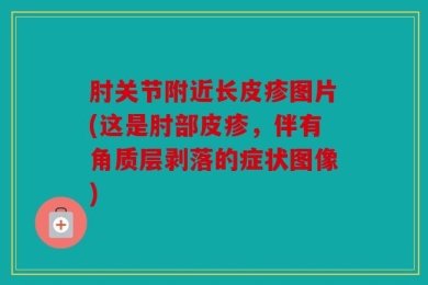 肘关节附近长皮疹图片(这是肘部皮疹，伴有角质层剥落的症状图像)