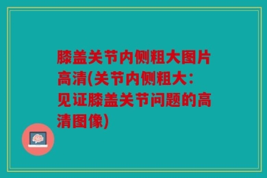 膝盖关节内侧粗大图片高清(关节内侧粗大：见证膝盖关节问题的高清图像)