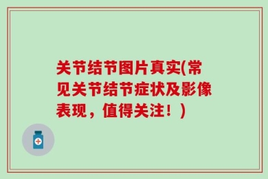 关节结节图片真实(常见关节结节症状及影像表现，值得关注！)