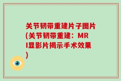 关节韧带重建片子图片(关节韧带重建：MRI显影片揭示手术效果)