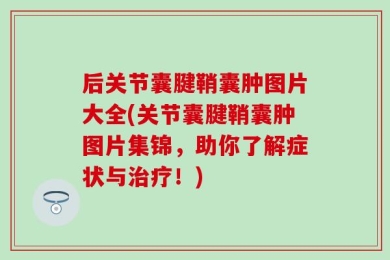 后关节囊腱鞘囊肿图片大全(关节囊腱鞘囊肿图片集锦，助你了解症状与治疗！)