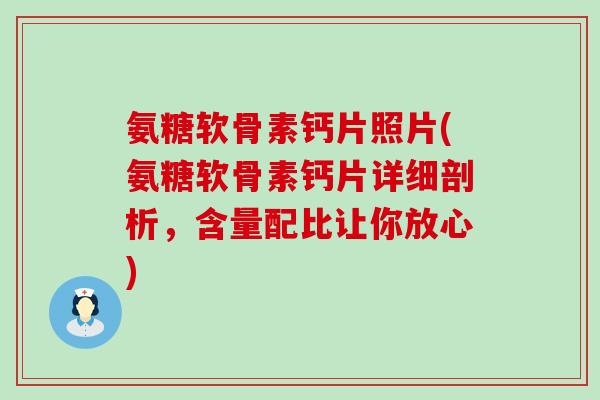 氨糖软骨素钙片照片(氨糖软骨素钙片详细剖析,含量配比让你放心) 氨糖软骨素钙片照片(氨糖软骨素钙片详细剖析,含量配比让你放心)