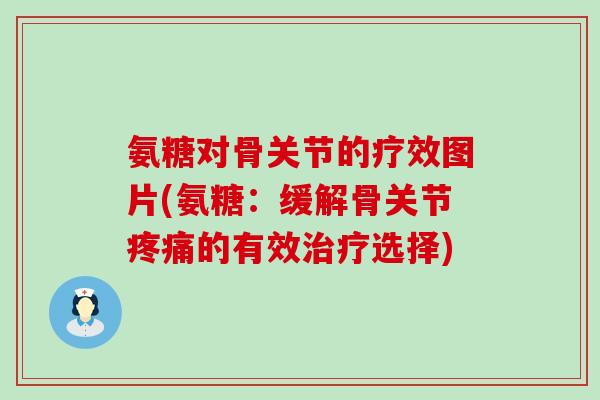 氨糖对骨关节的疗效图片(氨糖:缓解骨关节的有效选择) 氨糖对骨关节的疗效图片(氨糖:缓解骨关节的有效选择)