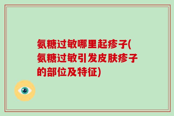 氨糖哪里起疹子(氨糖引发疹子的部位及特征)