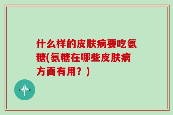 什么样的要吃氨糖(氨糖在哪些方面有用?) 什么样的要吃氨糖(氨糖在哪些方面有用?)