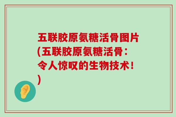 五联胶原氨糖活骨图片(五联胶原氨糖活骨:令人惊叹的生物技术!) 五联胶原氨糖活骨图片(五联胶原氨糖活骨:令人惊叹的生物技术!)