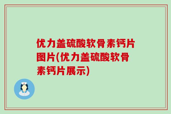 优力盖硫酸软骨素钙片图片(优力盖硫酸软骨素钙片展示) 优力盖硫酸软骨素钙片图片(优力盖硫酸软骨素钙片展示)