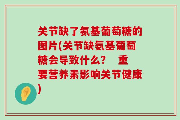 关节缺了氨基葡萄糖的图片(关节缺氨基葡萄糖会导致什么？  重要营养素影响关节健康)