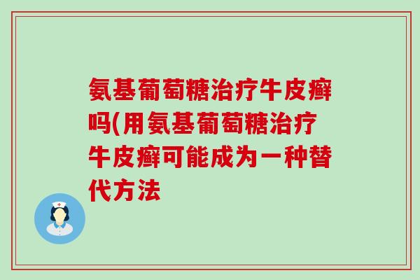 氨基葡萄糖牛皮癣吗(用氨基葡萄糖牛皮癣可能成为一种替代方法 氨基葡萄糖牛皮癣吗(用氨基葡萄糖牛皮癣可能成为一种替代方法