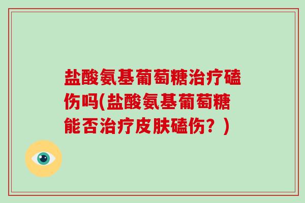 盐酸氨基葡萄糖磕伤吗(盐酸氨基葡萄糖能否磕伤?) 盐酸氨基葡萄糖磕伤吗(盐酸氨基葡萄糖能否磕伤?)