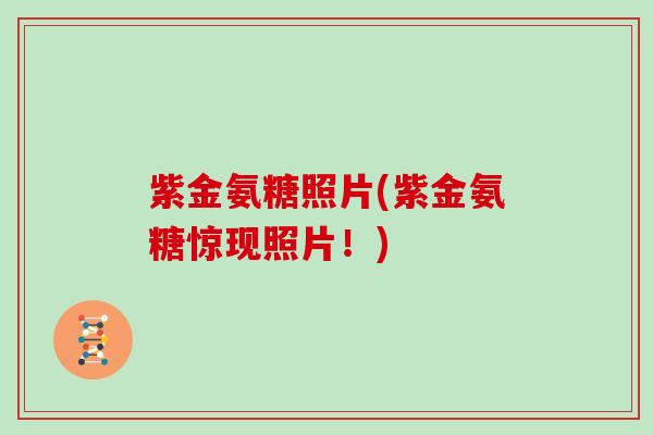 紫金氨糖照片(紫金氨糖惊现照片！)