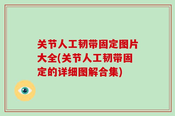 关节人工韧带固定图片大全(关节人工韧带固定的详细图解合集)