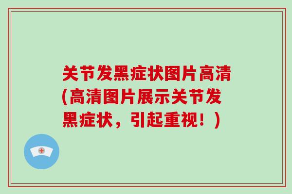 关节发黑症状图片高清(高清图片展示关节发黑症状，引起重视！)