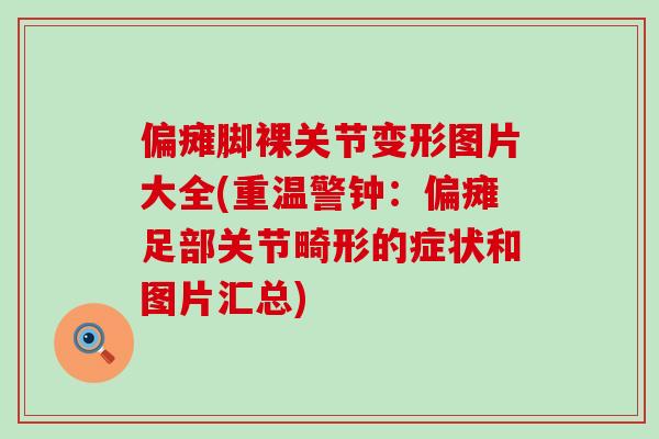 偏瘫脚裸关节变形图片大全(重温警钟:偏瘫足部关节畸形的症状和图片汇总) 偏瘫脚裸关节变形图片大全(重温警钟:偏瘫足部关节畸形的症状和图片汇总)