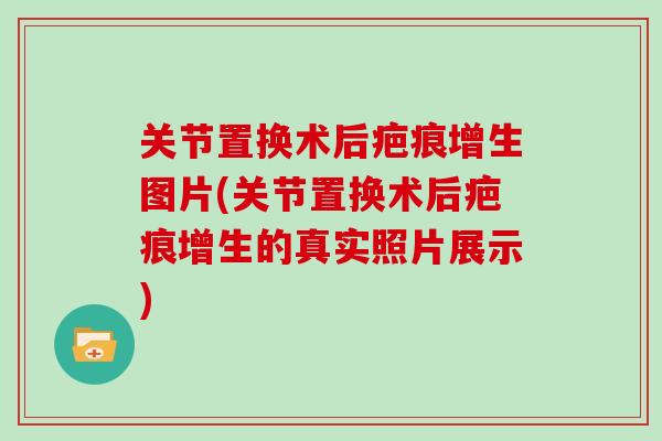 关节置换术后疤痕增生图片(关节置换术后疤痕增生的真实照片展示) 关节置换术后疤痕增生图片(关节置换术后疤痕增生的真实照片展示)
