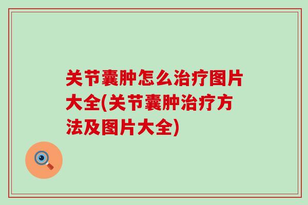 关节囊肿怎么图片大全(关节囊肿方法及图片大全)