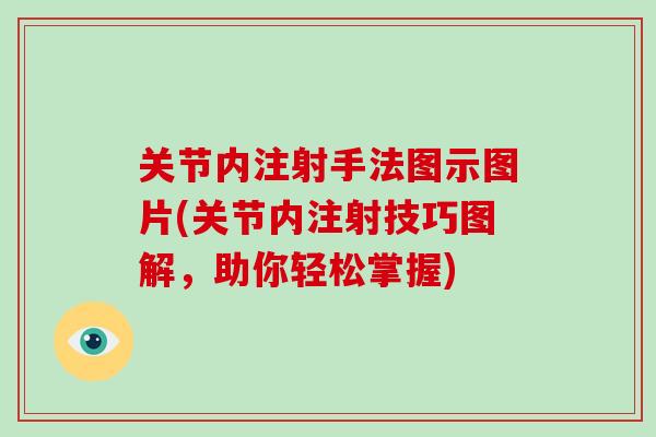 关节内注射手法图示图片(关节内注射技巧图解,助你轻松掌握) 关节内注射手法图示图片(关节内注射技巧图解,助你轻松掌握)