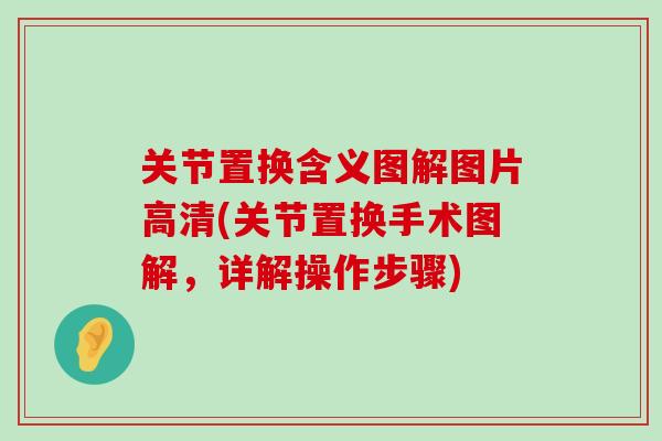 关节置换含义图解图片高清(关节置换手术图解,详解操作步骤) 关节置换含义图解图片高清(关节置换手术图解,详解操作步骤)