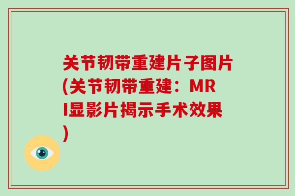 关节韧带重建片子图片(关节韧带重建：MRI显影片揭示手术效果)