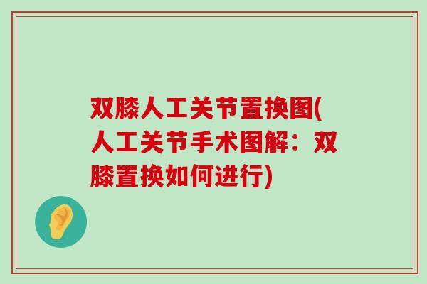 双膝人工关节置换图(人工关节手术图解:双膝置换如何进行) 双膝人工关节置换图(人工关节手术图解:双膝置换如何进行)