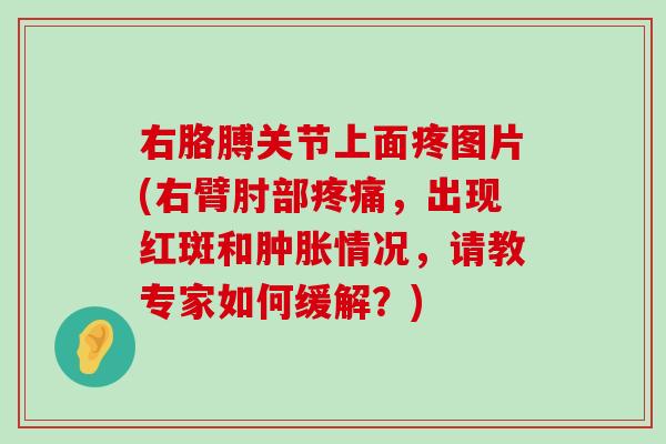 右胳膊关节上面疼图片(右臂肘部,出现红斑和情况,请教专家如何缓解?) 右胳膊关节上面疼图片(右臂肘部,出现红斑和情况,请教专家如何缓解?)