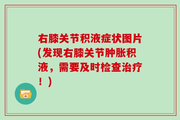 右膝关节积液症状图片(发现右膝关节积液,需要及时检查!) 右膝关节积液症状图片(发现右膝关节积液,需要及时检查!)