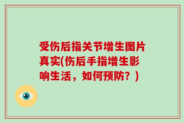 受伤后指关节增生图片真实(伤后手指增生影响生活,如何?) 受伤后指关节增生图片真实(伤后手指增生影响生活,如何?)