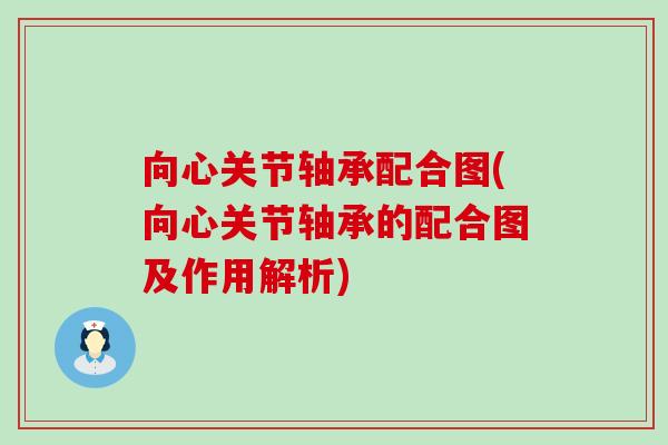 向心关节轴承配合图(向心关节轴承的配合图及作用解析) 向心关节轴承配合图(向心关节轴承的配合图及作用解析)