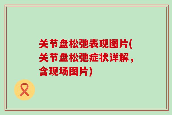 关节盘松弛表现图片(关节盘松弛症状详解,含现场图片) 关节盘松弛表现图片(关节盘松弛症状详解,含现场图片)
