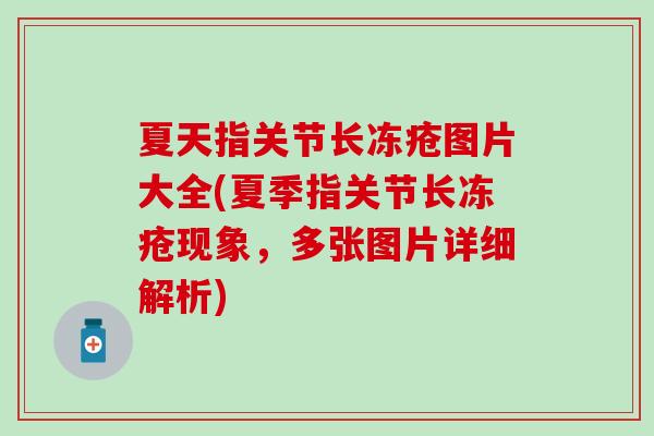 夏天指关节长冻疮图片大全(夏季指关节长冻疮现象,多张图片详细解析) 夏天指关节长冻疮图片大全(夏季指关节长冻疮现象,多张图片详细解析)