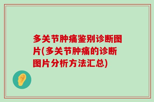 多关节肿痛鉴别诊断图片(多关节肿痛的诊断图片分析方法汇总) 多关节肿痛鉴别诊断图片(多关节肿痛的诊断图片分析方法汇总)
