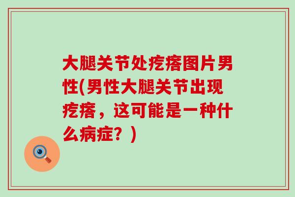 大腿关节处疙瘩图片男性(男性大腿关节出现疙瘩,这可能是一种什么症?) 大腿关节处疙瘩图片男性(男性大腿关节出现疙瘩,这可能是一种什么症?)