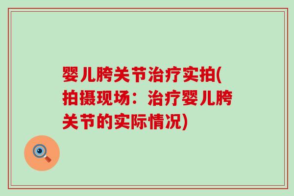 婴儿胯关节实拍(拍摄现场：婴儿胯关节的实际情况)