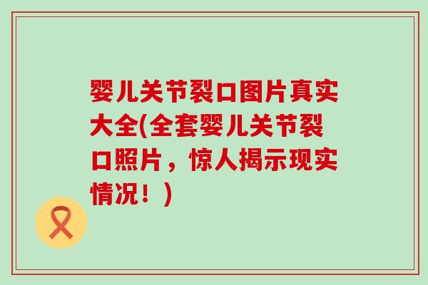 婴儿关节裂口图片真实大全(全套婴儿关节裂口照片,惊人揭示现实情况!) 婴儿关节裂口图片真实大全(全套婴儿关节裂口照片,惊人揭示现实情况!)