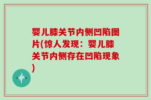 婴儿膝关节内侧凹陷图片(惊人发现:婴儿膝关节内侧存在凹陷现象) 婴儿膝关节内侧凹陷图片(惊人发现:婴儿膝关节内侧存在凹陷现象)