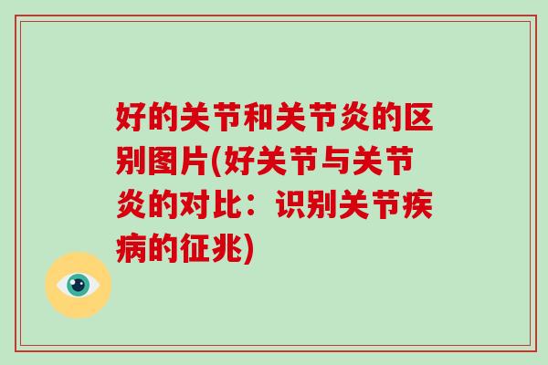 好的关节和的区别图片(好关节与的对比：识别关节的征兆)
