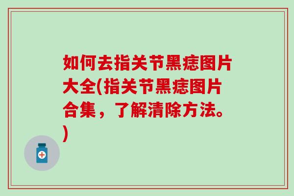 如何去指关节黑痣图片大全(指关节黑痣图片合集，了解清除方法。)