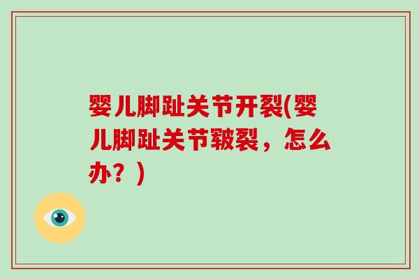 婴儿脚趾关节开裂(婴儿脚趾关节皲裂,怎么办?) 婴儿脚趾关节开裂(婴儿脚趾关节皲裂,怎么办?)