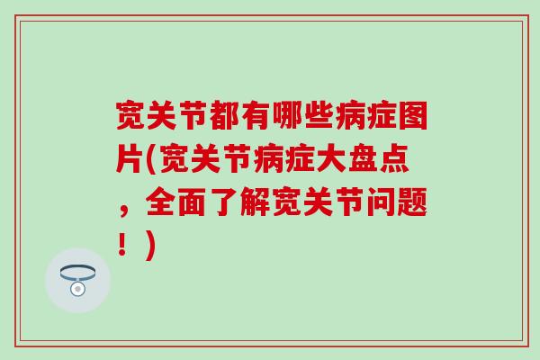 宽关节都有哪些症图片(宽关节症大盘点,全面了解宽关节问题!) 宽关节都有哪些症图片(宽关节症大盘点,全面了解宽关节问题!)